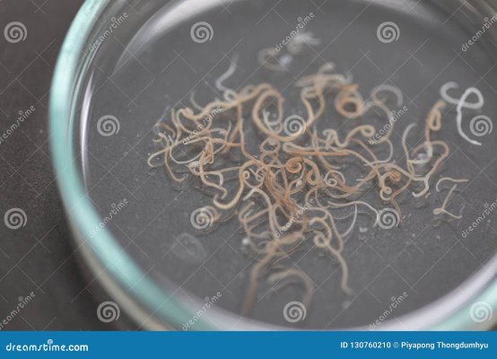 аскаридоз-заболевание-причиненное-паразитными-lumbricoides-ascaris-roundworm-для-130760210 (1).jpg